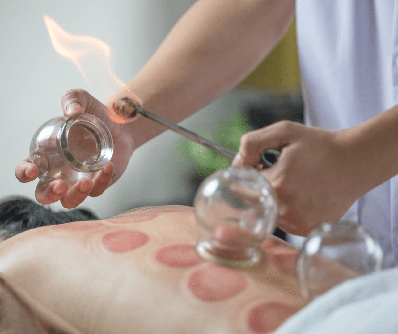 A collection of Traditional Chinese Medicine (TCM) elements, including acupuncture needles, dried herbs, and a mortar and pestle, arranged on a wooden table with an ancient Chinese medical text in the background.